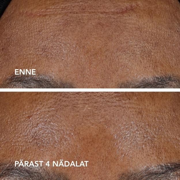 creme 1,2 % BA AGELESS+ Retinoolikreem 1,2%