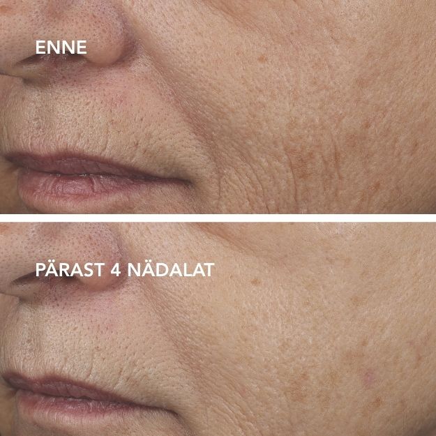 masque 0,5% BA AGELESS+ Öömask retinooliga 0,5%