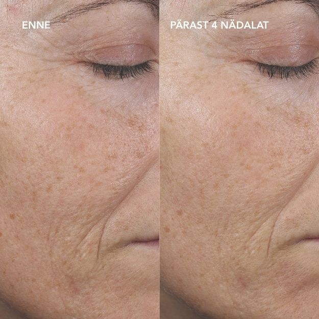 retinol serum 0.3 % BA (1) AGELESS+ Ретиноловый серум 0,3 %