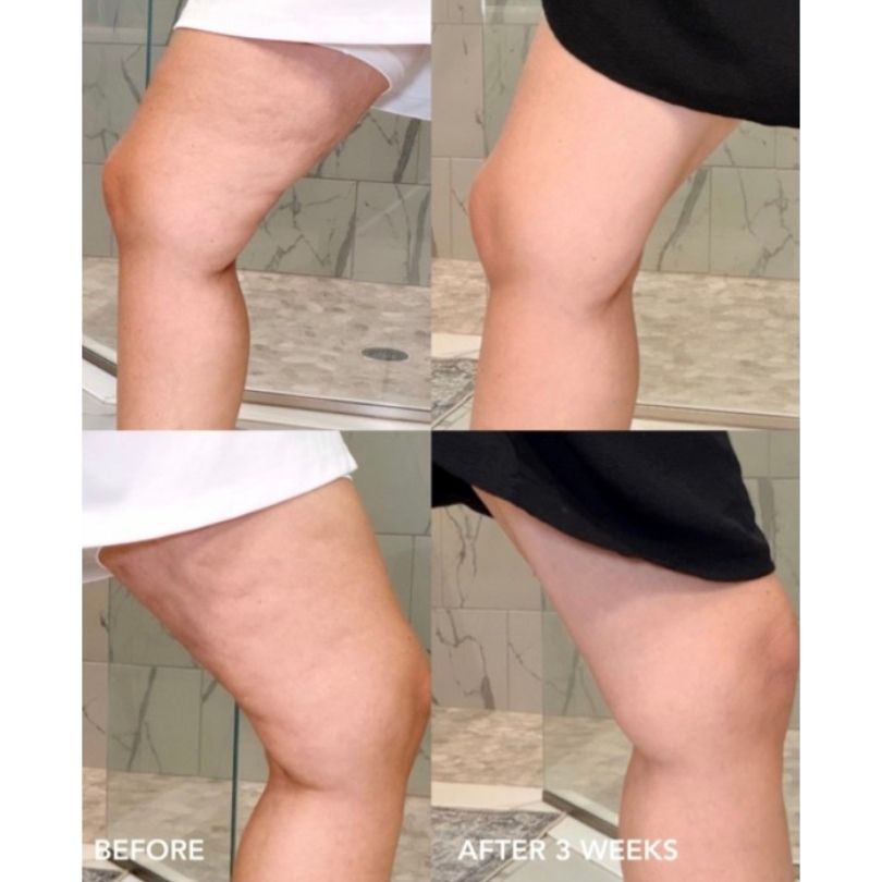 VUL Body BA 3w legs VOL.U.LIFT™ BODY pinguldav kehakreem