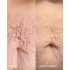 VUL body BA w3 tummy VOL.U.LIFT™ BODY pinguldav kehakreem