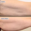 VOL.U.LIFT™ BODY подтягивающий крем для тела