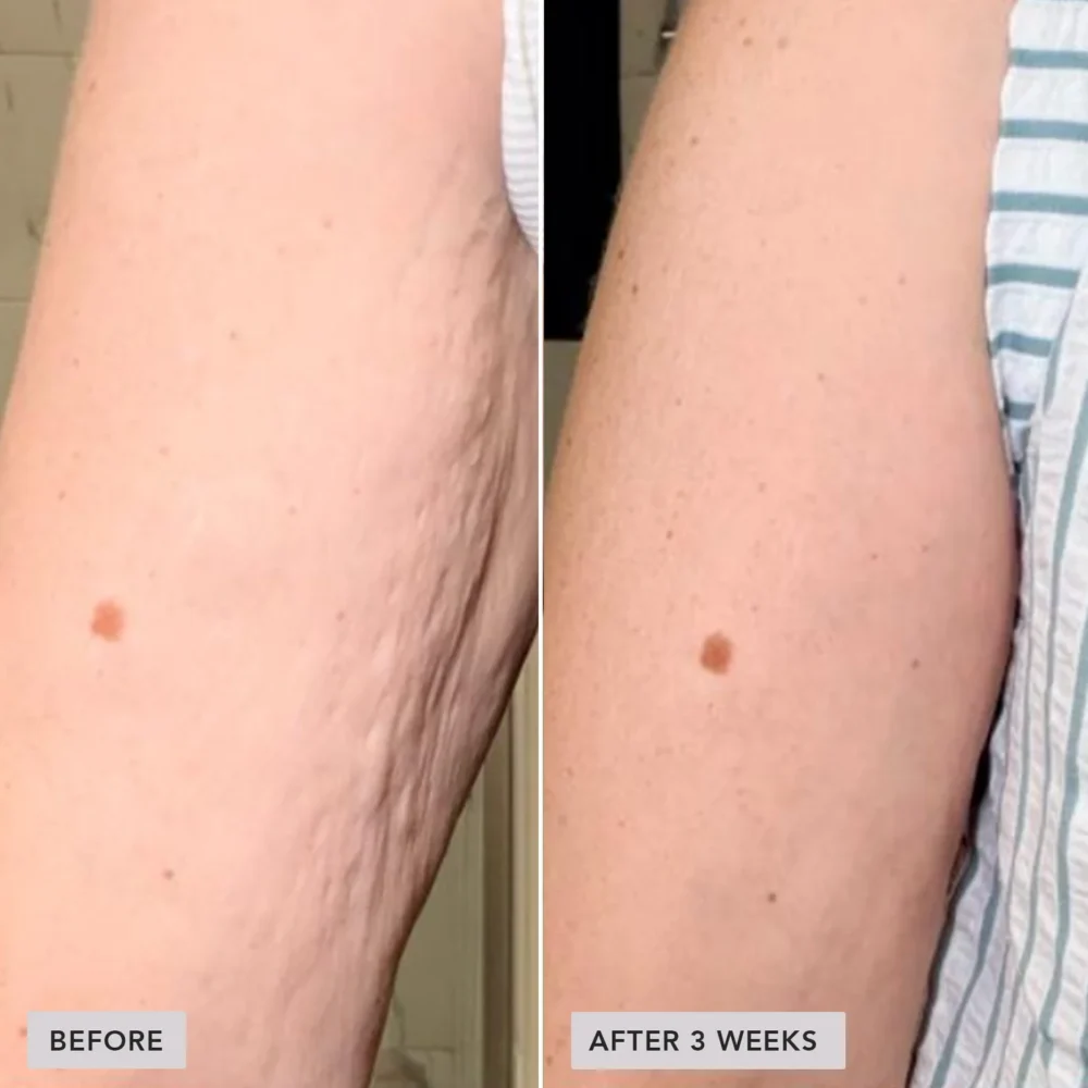 VOL.U.LIFT™ BODY подтягивающий крем для тела