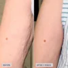 VOL.U.LIFT™ BODY подтягивающий крем для тела