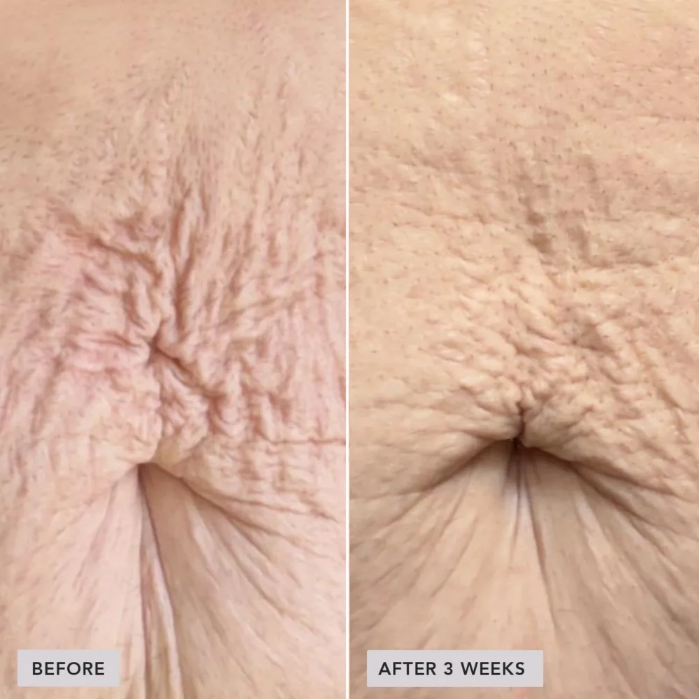 VOL.U.LIFT™ BODY подтягивающий крем для тела